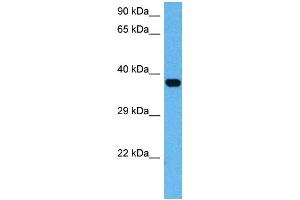 Host:  Mouse  Target Name:  ATF4  Sample Tissue:  Mouse Brain  Antibody Dilution:  1ug/ml (ATF4 antibody)