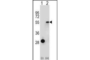 Western blot analysis of ESRRA (arrow) using rabbit polyclonal ESRRA Antibody (Center) (ABIN652575 and ABIN2842387). (ESRRA antibody  (AA 131-159))