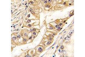 Immunohistochemistry (IHC) image for anti-EPH Receptor B2 (EPHB2) antibody (ABIN3030824)