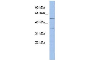 Human ACHN; WB Suggested Anti-ABHD15 Antibody Titration: 0. (ABHD15 antibody  (Middle Region))