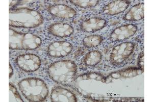 Immunoperoxidase of monoclonal antibody to STK38 on formalin-fixed paraffin-embedded human colon. (STK38 antibody  (AA 365-465))