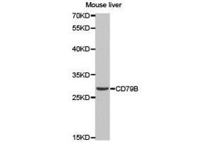 Western Blotting (WB) image for anti-CD79b Molecule, Immunoglobulin-Associated beta (CD79B) antibody (ABIN1871654) (CD79b antibody)