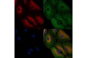 ABIN6262303 and ABIN6276781 staining  cells by IF/ICC.