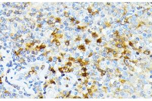 Immunohistochemistry of paraffin-embedded Human tonsil using SPTA1 Polyclonal Antibody at dilution of 1:100 (40x lens). (SPTA1 antibody)