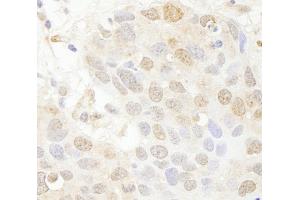 Immunohistochemistry (IHC) image for anti-SET Domain Containing 8 Pseudogene 1 (SETD8P1) (AA 316-366) antibody (ABIN7448789) (SET7 antibody  (AA 316-366))