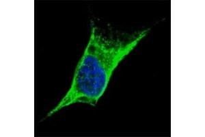 Fluorescent confocal image of SY5Y cells stained with anti-Vimentin antibody at 1:100. (Vimentin antibody  (AA 430-457))