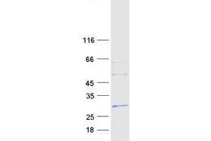 Western Blotting (WB) image for Fibronectin Type III Domain Containing 4 (FNDC4) protein (Myc-DYKDDDDK Tag) (ABIN2721264)