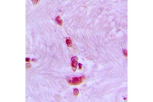Immunohistochemical analysis of CDC40 staining in human brain formalin fixed paraffin embedded tissue section. (CDC40 antibody  (Center))