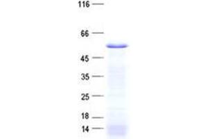 Validation with Western Blot (ZNF621 Protein (His tag))