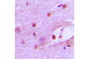 Immunohistochemical analysis of MSH6 staining in human brain formalin fixed paraffin embedded tissue section. (MSH6 antibody  (Center))