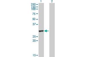 Western Blot analysis of HYAL1 expression in transfected 293T cell line by HYAL1 MaxPab polyclonal antibody. (HYAL1 antibody  (AA 1-253))