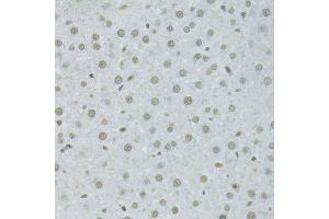Immunohistochemistry (Paraffin-embedded Sections) (IHC (p)) image for anti-Heterogeneous Nuclear Ribonucleoprotein K (HNRNPK) (AA 1-280) antibody (ABIN3022414)