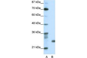 Western Blotting (WB) image for anti-Sin3A-Associated Protein, 30kDa (SAP30) antibody (ABIN2461707) (SAP30 antibody)