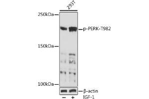 Western blot analysis of extracts of 293T cells, using Phospho-PERK-T982 Rabbit pAb (ABIN7267032) at 1:1000 dilution. (PERK antibody  (pThr982))