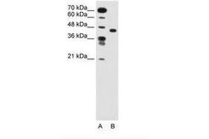 Image no. 1 for anti-Solute Carrier Family 35, Member C1 (SLC35C1) (AA 51-100) antibody (ABIN205019) (SLC35C1 antibody  (AA 51-100))