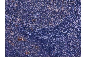 Image no. 1 for anti-Sequestosome 1 (SQSTM1) antibody (ABIN1499987) (SQSTM1 antibody)