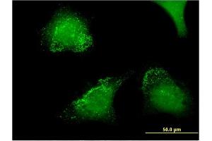 Immunofluorescence of monoclonal antibody to ACP5 on HeLa cell. (ACP5 antibody  (AA 72-158))