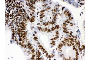 Immunohistochemistry (Paraffin-embedded Sections) (IHC (p)) image for anti-Retinoblastoma Binding Protein 4 (RBBP4) (AA 395-425), (C-Term) antibody (ABIN3043920) (Retinoblastoma Binding Protein 4 antibody  (C-Term))