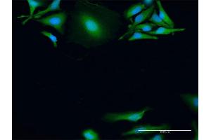 Immunofluorescence of purified MaxPab antibody to MAPKAPK2 on HeLa cell. (MAPKAP Kinase 2 antibody  (AA 1-400))