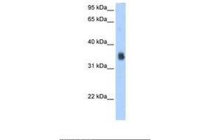 Image no. 2 for anti-Solute Carrier Family 35, Member F2 (SLC35F2) (N-Term) antibody (ABIN320842) (SLC35F2 antibody  (N-Term))