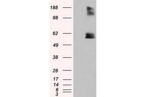 HEK293T cells were transfected with the pCMV6-ENTRY control (Left lane) or pCMV6-ENTRY LIPG (Right lane) cDNA for 48 hrs and lysed. (LIPG antibody)