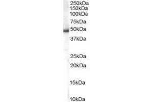 ABIN2560056 staining (1µg/ml) of Jurkat lysate (RIPA buffer, 35µg total protein per lane). (SNX5 antibody  (C-Term))