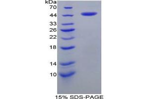 SDS-PAGE analysis of Human CRH Protein.