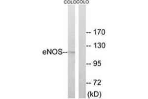 Western Blotting (WB) image for anti-Nitric Oxide Synthase 3 (Endothelial Cell) (NOS3) (AA 462-511) antibody (ABIN2888982) (ENOS antibody  (AA 462-511))