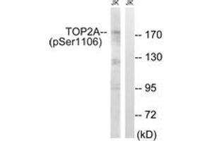 Western blot analysis of extracts from Jurkat cells treated with paclitaxel 1uM 24h, using TOP2A (Phospho-Ser1106) Antibody. (Topoisomerase II alpha antibody  (pSer1106))