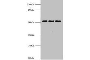 Western blot All lanes: BAG family molecular chaperone regulator 5 antibody at 2 μg/mL Lane 1: Mouse kidney tissue Lane 2: Mouse brain tissue Lane 3: Hela whole cell lysate Secondary Goat polyclonal to rabbit IgG at 1/10000 dilution Predicted band size: 52, 57 kDa Observed band size: 52 kDa (BAG5 antibody  (AA 1-447))