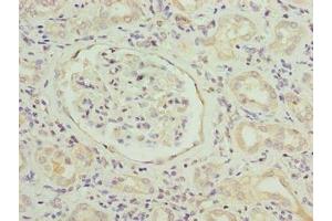 Immunohistochemistry of paraffin-embedded human kidney tissue using ABIN7169799 at dilution of 1:100 (SLITRK4 antibody  (AA 201-500))