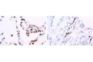 Image no. 3 for anti-Heterogeneous Nuclear Ribonucleoprotein A1 (HNRNPA1) antibody (ABIN108609) (HNRNPA1 antibody)