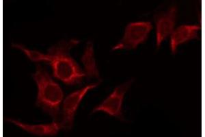 ABIN6267368 staining HepG2 by IF/ICC. (FGFR1 antibody  (pTyr766))