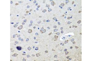 Immunohistochemistry of paraffin-embedded Mouse brain using CHRNB2 Polyclonal Antibody at dilution of 1:100 (40x lens). (CHRNB2 antibody)