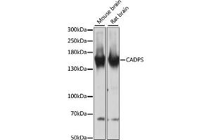 Western blot analysis of extracts of various cell lines, using CADPS antibody (ABIN6131298, ABIN6137843, ABIN6137844 and ABIN6217089) at 1:3000 dilution. (CADPS antibody  (AA 1020-1100))