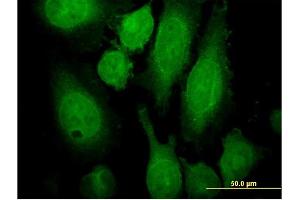 Immunofluorescence of monoclonal antibody to RAB3A on HeLa cell. (RAB3A antibody  (AA 122-220))