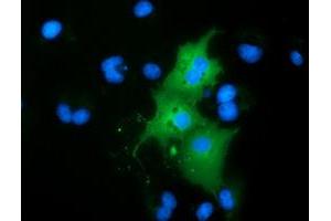 Anti-RBBP9 mouse monoclonal antibody (ABIN2453591) immunofluorescent staining of COS7 cells transiently transfected by pCMV6-ENTRY RBBP9 (RC202090). (RBBP9 antibody)