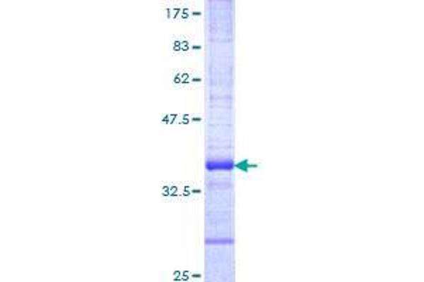 RNF26 Protein (AA 344-433) (GST tag)