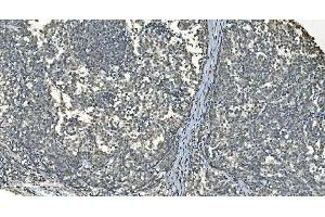 IHC analysis of LSM8 using anti-LSM8 antibody (ABIN7599579).
