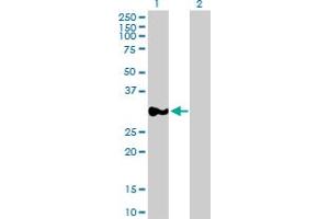 RPRD1A antibody  (AA 1-289)