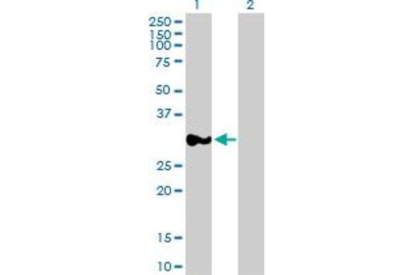 RPRD1A antibody  (AA 1-289)