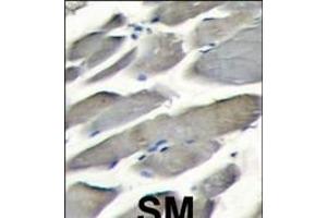 Formalin-fixed and paraffin-embedded skeletal muscle tissue reacted with PI3KCG antibody (Center) (ABIN392817 and ABIN2842248) , which was peroxidase-conjugated to the secondary antibody, followed by DAB staining. (PIK3 gamma antibody  (AA 518-547))