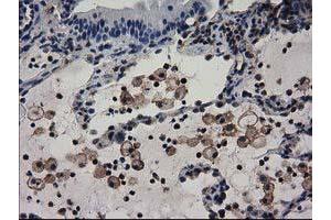 Immunohistochemical staining of paraffin-embedded Human Kidney tissue using anti-ADSL mouse monoclonal antibody. (Adenylosuccinate Lyase antibody)