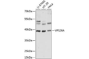 Western blot analysis of extracts of various cell lines, using VPS26A antibody  at 1:1000 dilution. (VPS26A antibody  (AA 208-327))