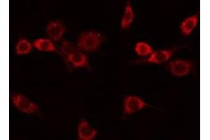 ABIN6275306 staining COLO205 by IF/ICC. (NEGR1 antibody  (Internal Region))