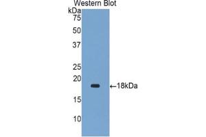 Western blot analysis of the recombinant protein. (Gastrokine 1 antibody  (AA 53-192))