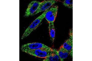 Confocal immunofluorescent analysis of EIF5AL1 Antibody (C-term)(Cat#AP51404PU-N) with A2058 cell followed by Alexa Fluor 488-conjugated goat anti-rabbit lgG (green). (EIF5AL1 antibody  (C-Term))