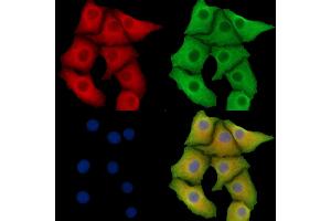 ABIN7095798 and ABIN7099860 staining Hela cells by IF/ICC.