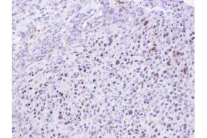 IHC-P Image Immunohistochemical analysis of paraffin-embedded SAS xenograft, using KRR1, antibody at 1:500 dilution. (KRR1 antibody)