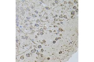 Immunohistochemistry of paraffin-embedded mouse brain using AR antibody (ABIN5971084) (40x lens). (Androgen Receptor antibody)